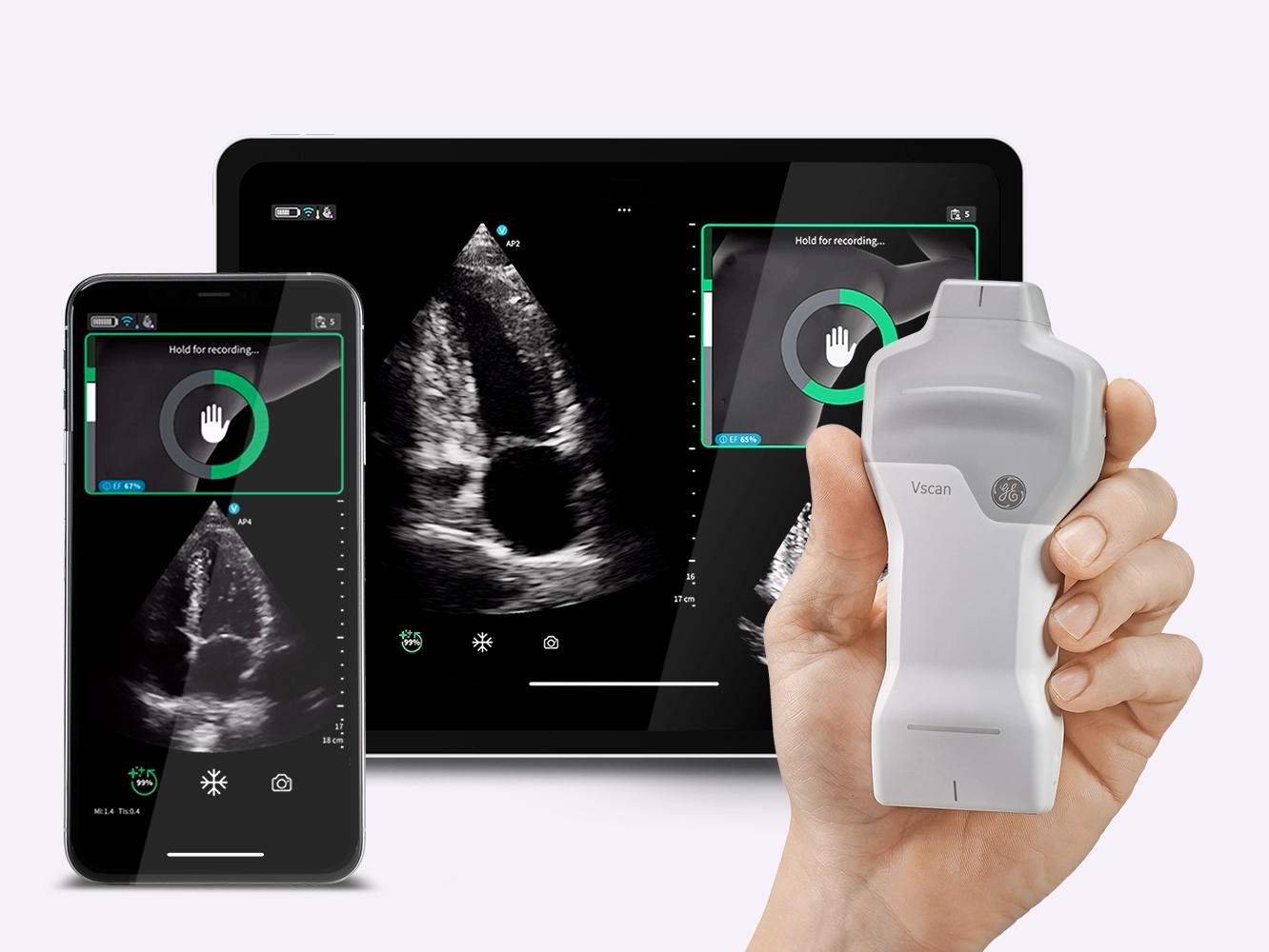 caption-ai-section-Rapid-echocardiography Osteopatía Estructural